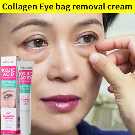 Collagen Eye Cream – Anti-Dark Circles & Puffiness