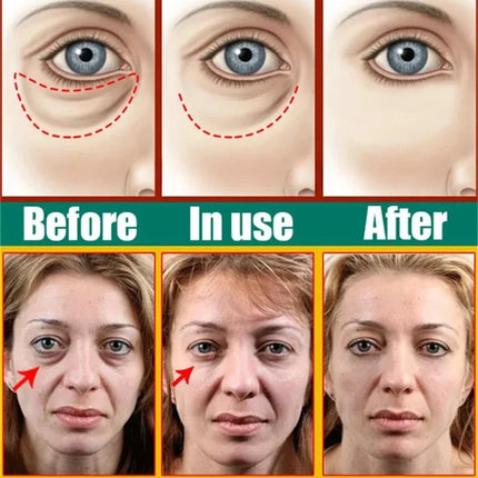 Collagen Eye Cream – Anti-Dark Circles & Puffiness