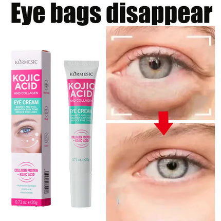 Collagen Eye Cream – Anti-Dark Circles & Puffiness