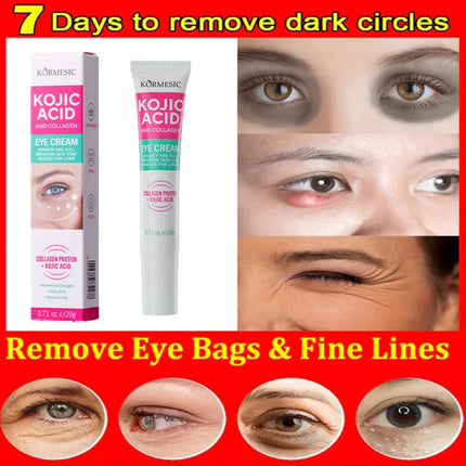 Collagen Eye Cream – Anti-Dark Circles & Puffiness