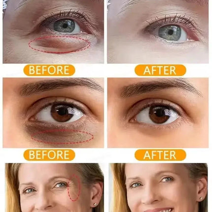 Collagen Eye Cream – Anti-Dark Circles & Puffiness